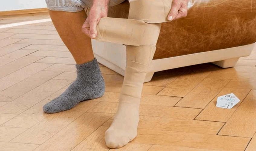 Compression stockings for lymphedema