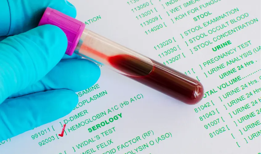 Hemoglobin A1C test